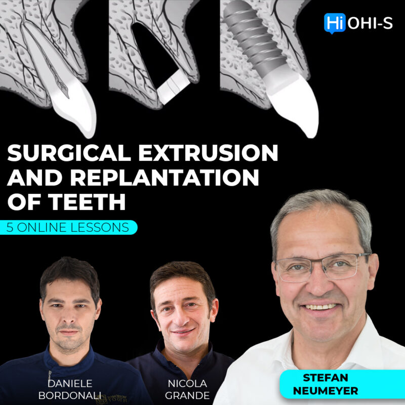 Surgical Extrusion and Replantation of Teeth