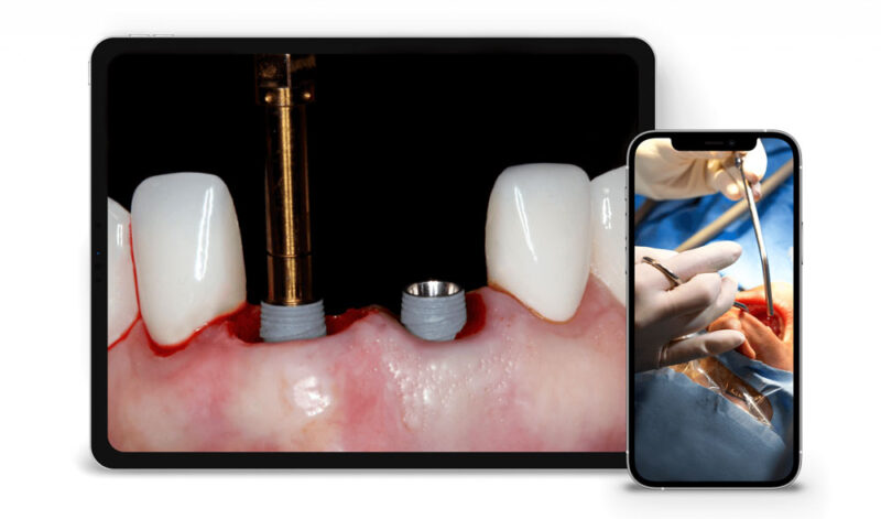 Gidental Online Residency Program: A-Z in Implant Dentistry