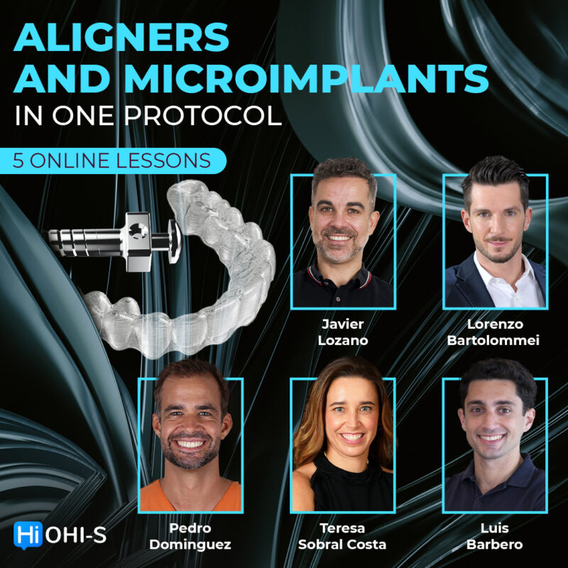 Aligners and Microimplants in One Protocol