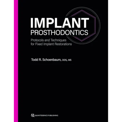 Implant Prosthodontics: Protocols and Techniques for Fixed Implant Restorations