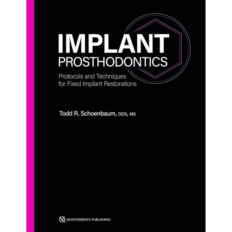 Implant Prosthodontics: Protocols and Techniques for Fixed Implant Restorations