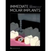 Immediate Molar Implants