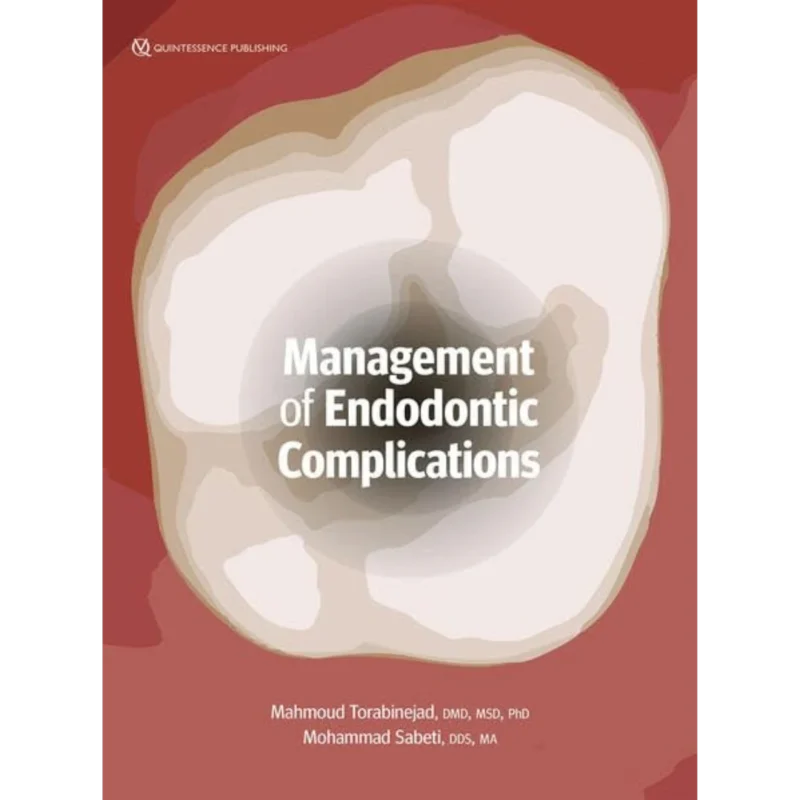 Management of Endodontic Complications: From Diagnosis to Prognosis