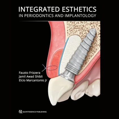 Integrated Esthetics in Periodontics and Implantology