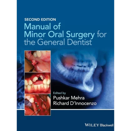 Manual of Minor Oral Surgery for the General Dentist