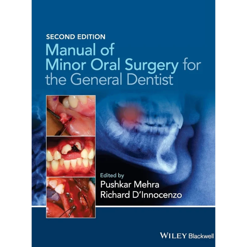 Manual of Minor Oral Surgery for the General Dentist