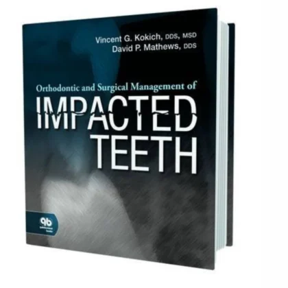 Orthodontic and Surgical Management of Impacted Teeth