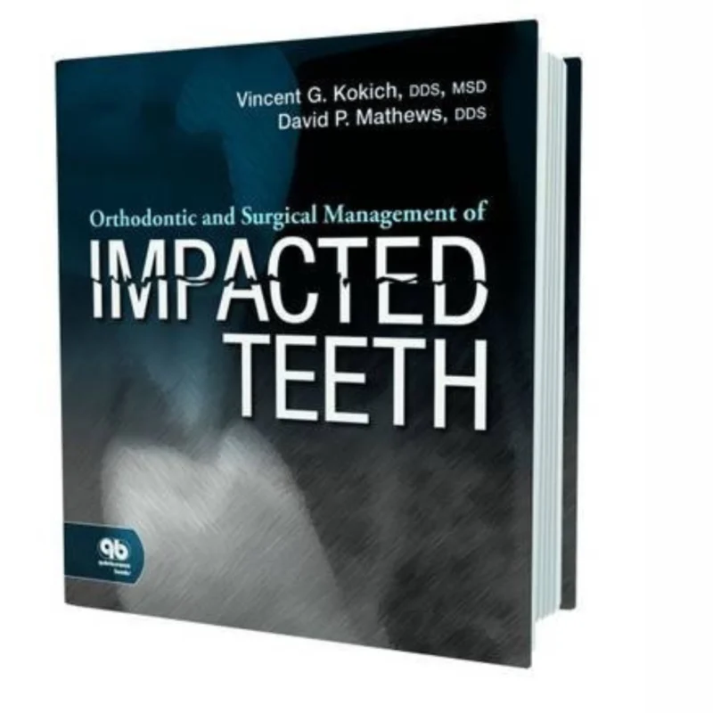 Orthodontic and Surgical Management of Impacted Teeth