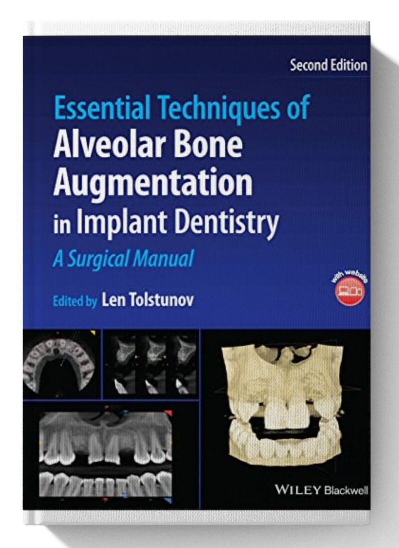 Essential Techniques of Alveolar Bone Augmentation in Implant Dentistry: A Surgical Manual 2nd Edition