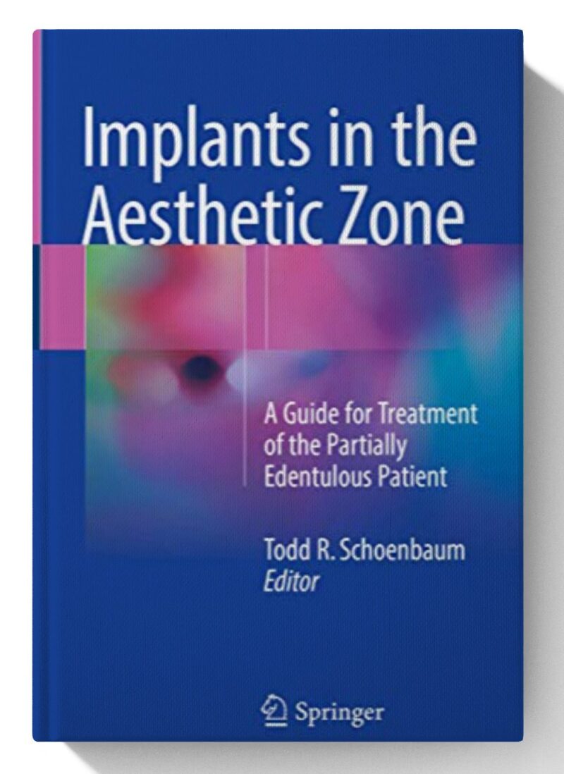 Implants in the Aesthetic Zone: A Guide for Treatment of the Partially Edentulous Patient 1st ed.