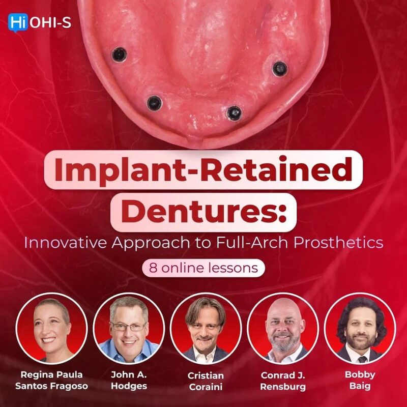 OHI-S Implant-Retained Dentures Innovative Approach to Full-Arch Prosthetics