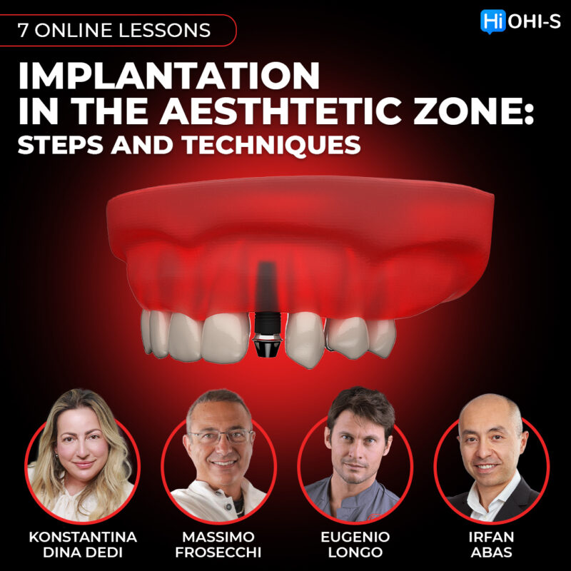 Implant placement in the aesthetic zone: steps and techniques