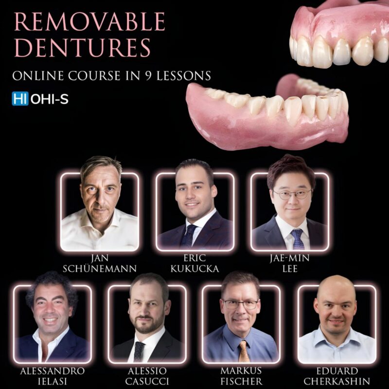 Removable dentures