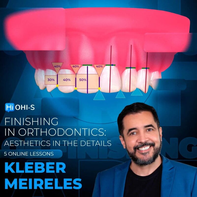 Finishing in orthodontics: aesthetics in the details