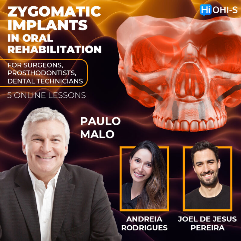 Zygomatic implants in oral rehabilitation. For surgeons, prosthodontists, dental technicians