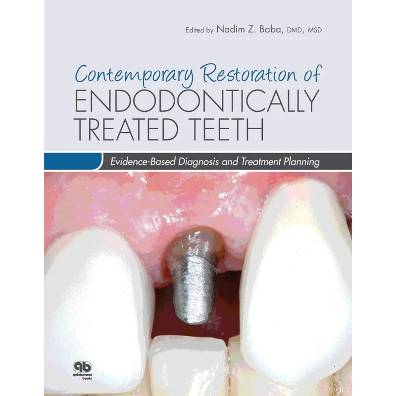Contemporary Restoration of Endodontically Treated Teeth: Evidence-Based Diagnosis and Treatment Planning