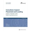 Immediate Implant Placement and Loading: Single or Multiple Teeth Requiring Replacement