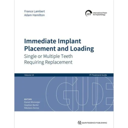 Immediate Implant Placement and Loading: Single or Multiple Teeth Requiring Replacement