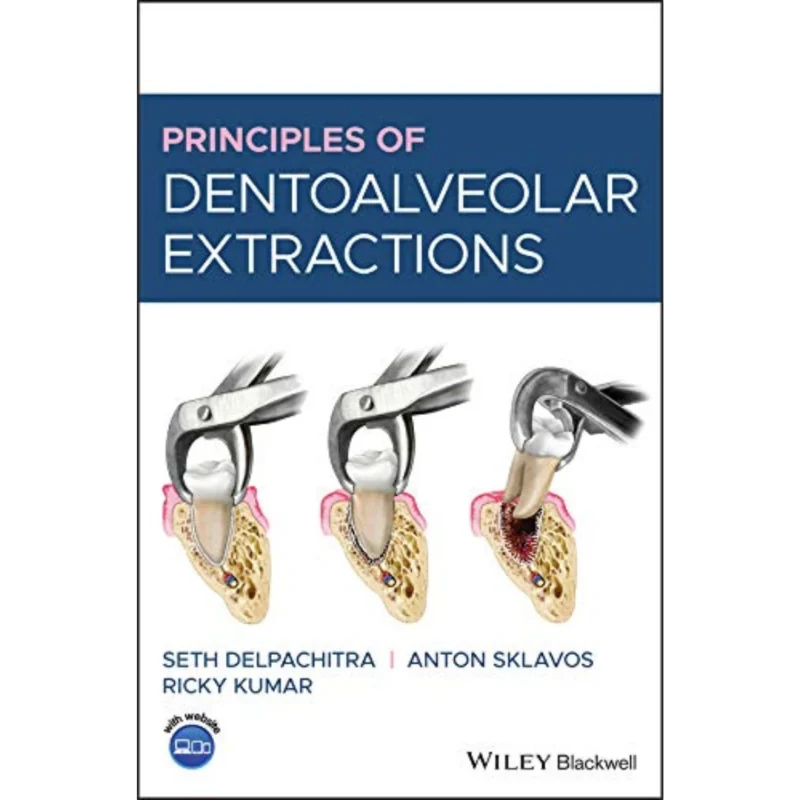 Principles of Dentoalveolar Extractions