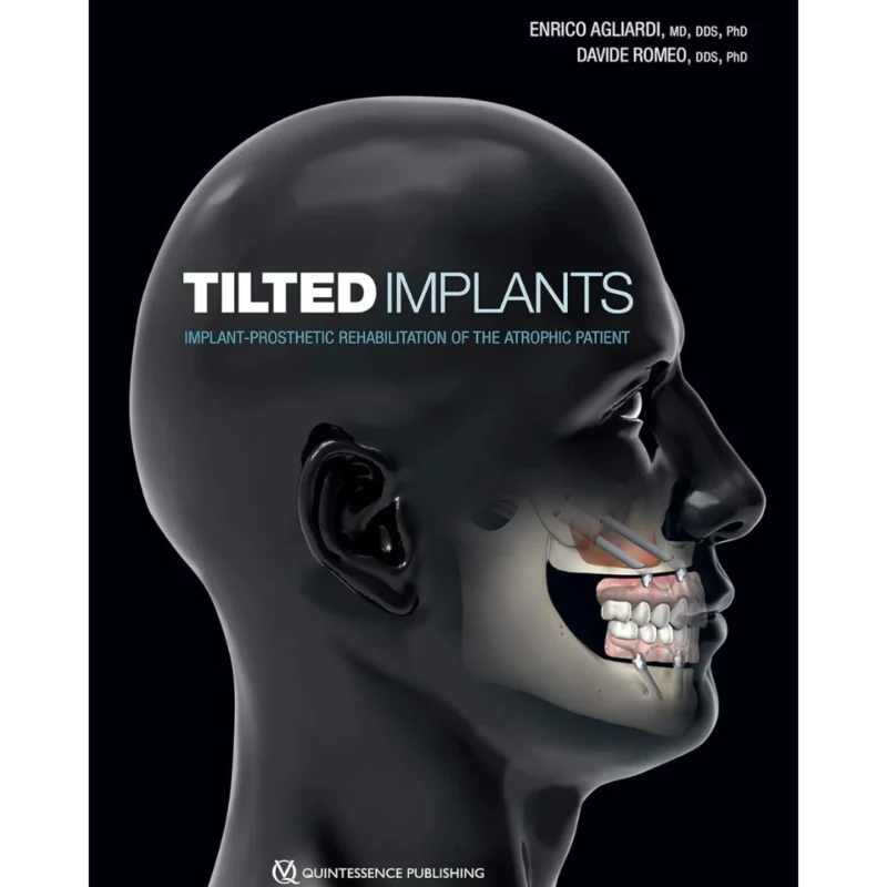 Tilted Implants: Implant-prosthetic Rehabilitation of the Atrophic Patient